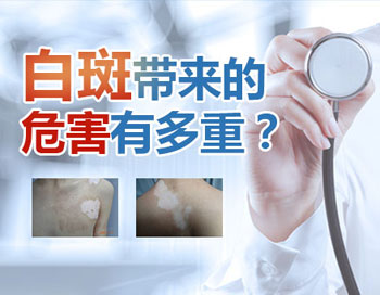 溫州看白癜風(fēng)哪家好